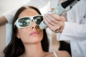 laser skin rejuvenation