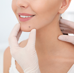 Chin skin lesion treatment at Kingsway Dermatology