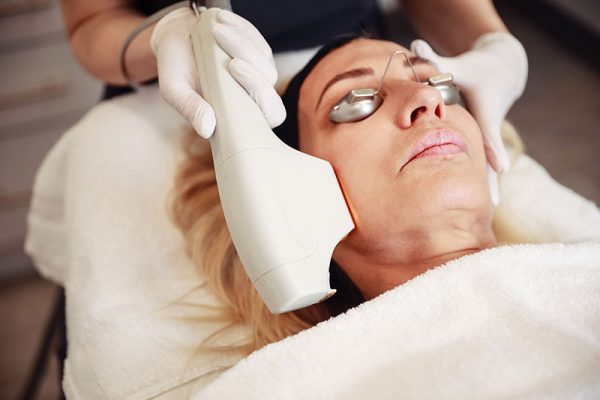 Woman getting treated for a BBL hero at Kingsway Dermatology
