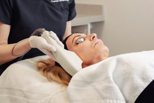 Woman having a BBL hero treatment at Kingsway Dermatology
