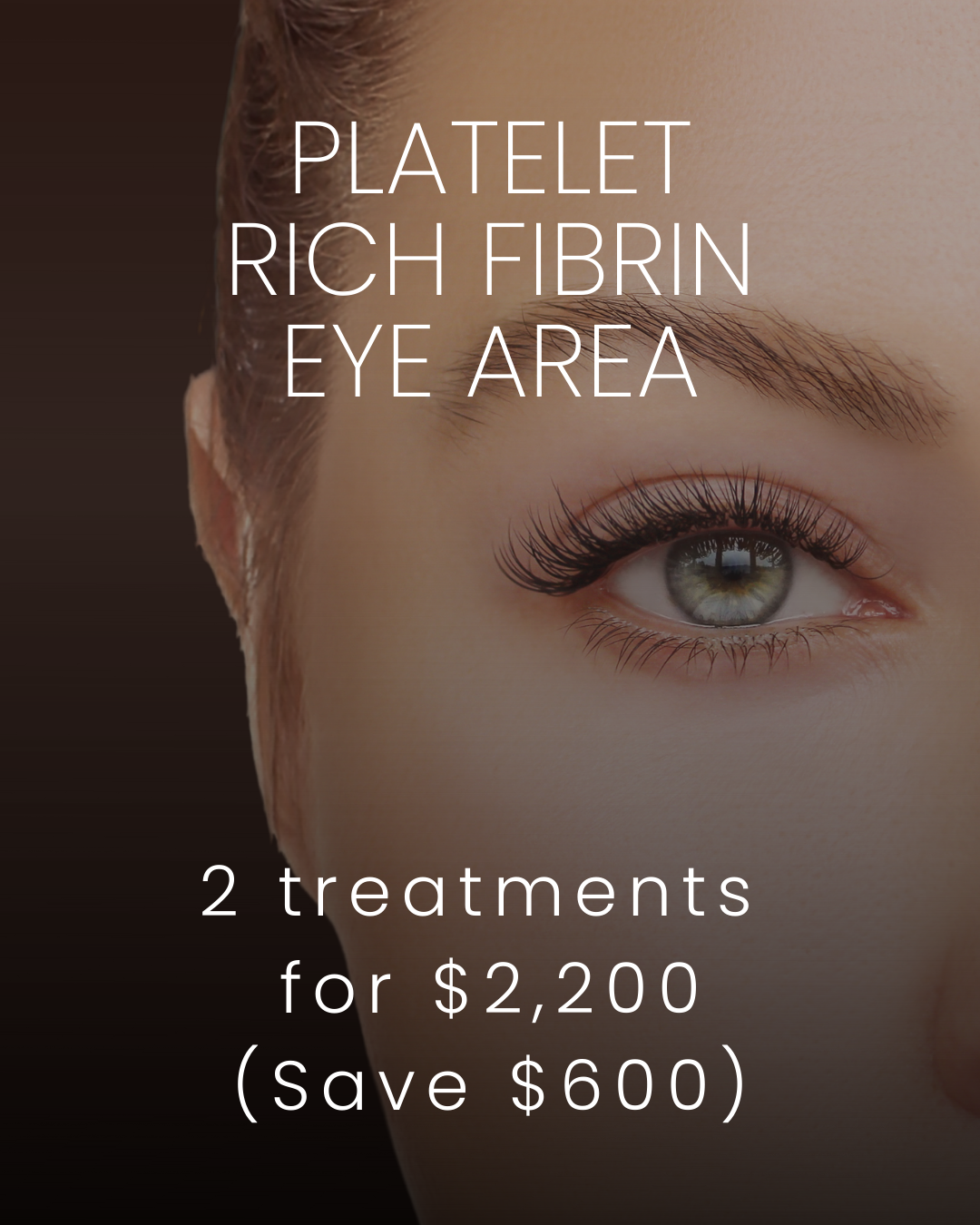 prf eye promo feb 26